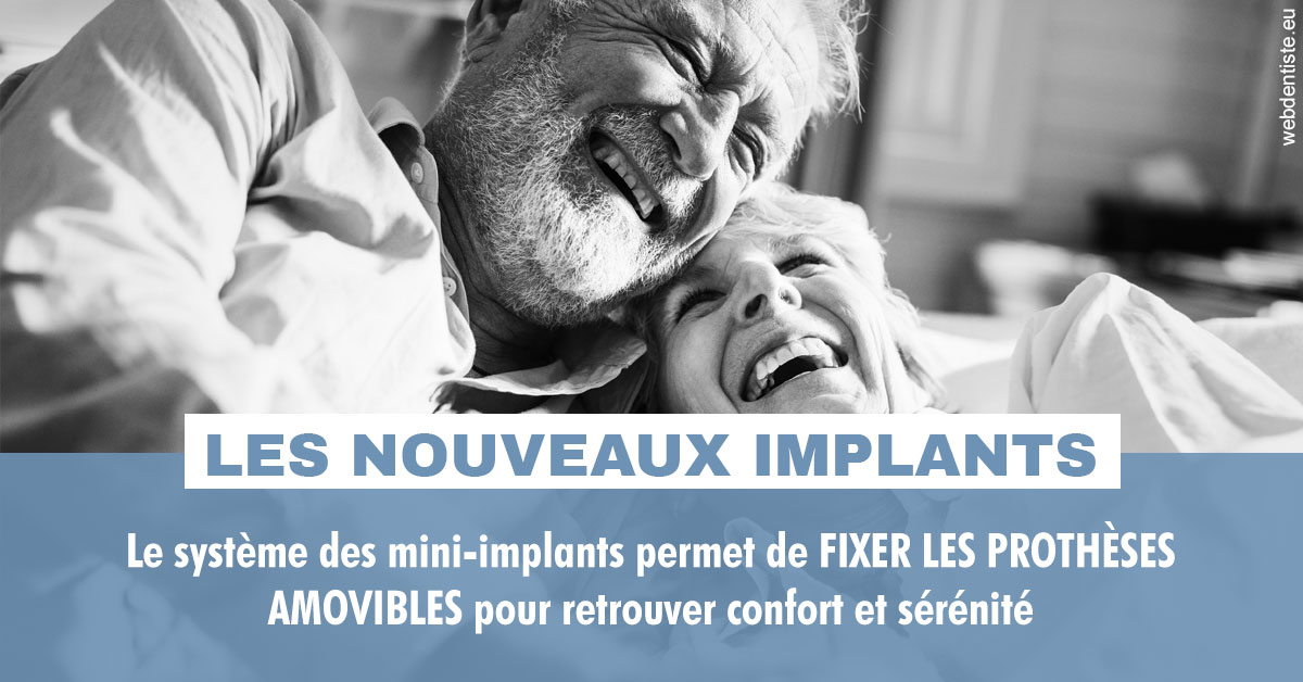 https://www.centredentairetoulon.fr/Les nouveaux implants 2