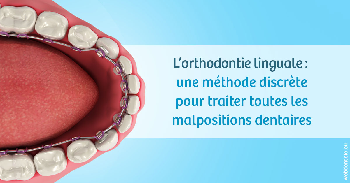 https://www.centredentairetoulon.fr/L'orthodontie linguale 1