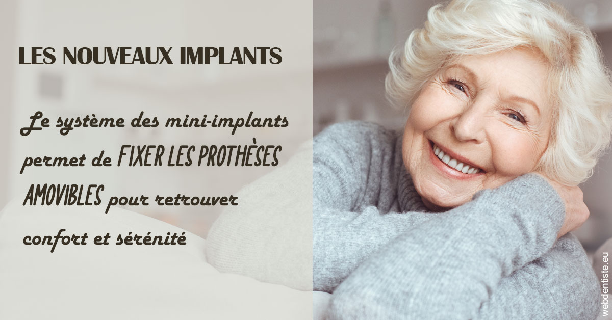 https://www.centredentairetoulon.fr/Les nouveaux implants 1