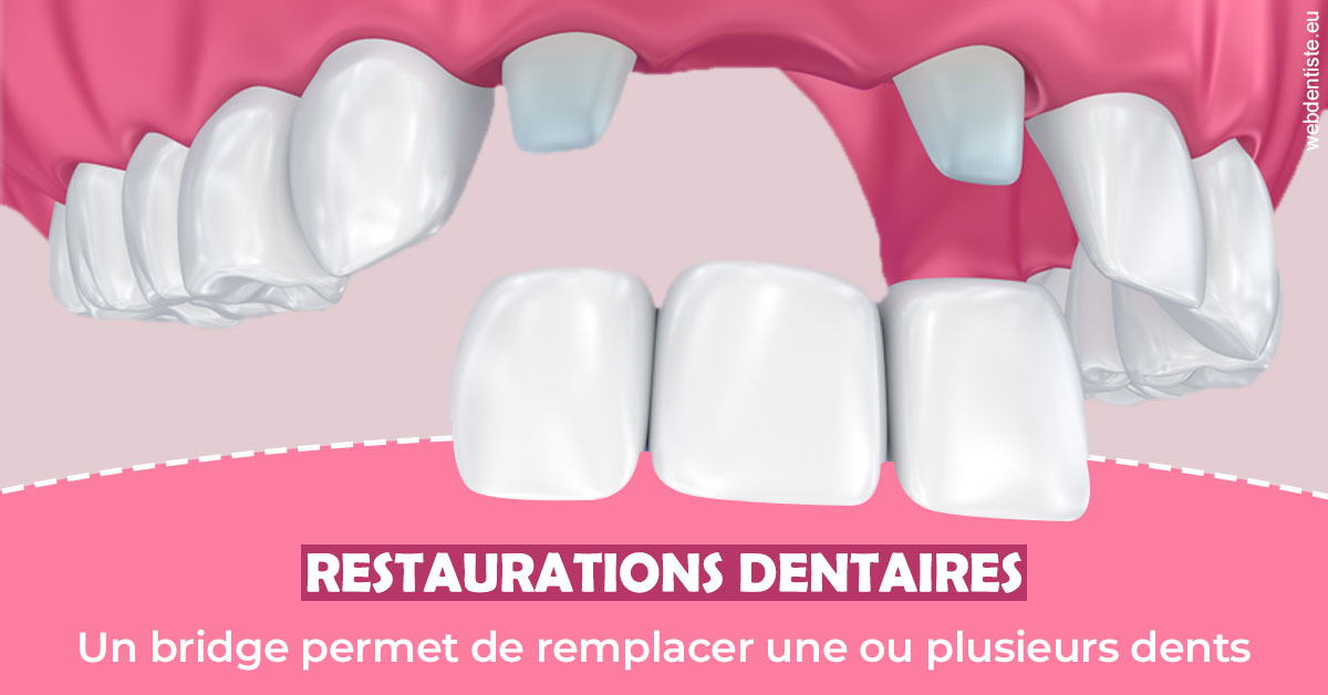 https://www.centredentairetoulon.fr/Bridge remplacer dents 2