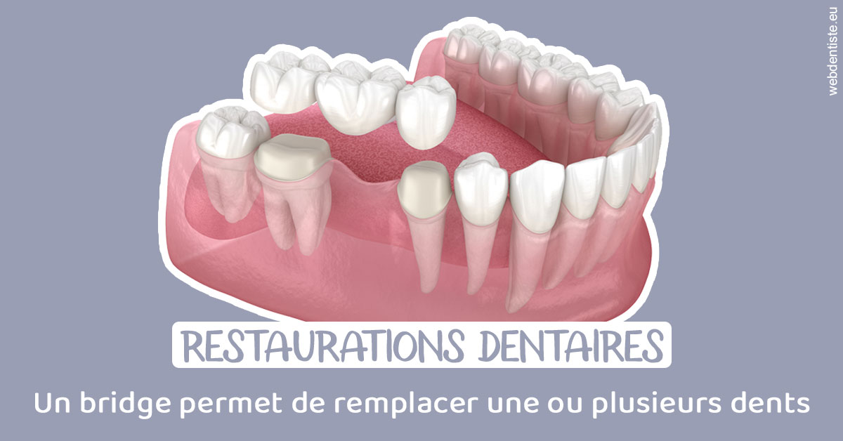 https://www.centredentairetoulon.fr/Bridge remplacer dents 1