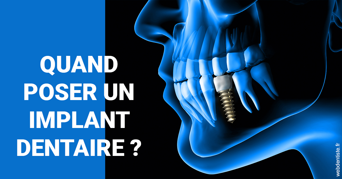 https://www.centredentairetoulon.fr/Les implants 1