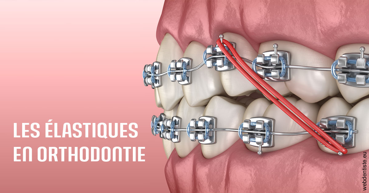https://www.centredentairetoulon.fr/Elastiques orthodontie 2