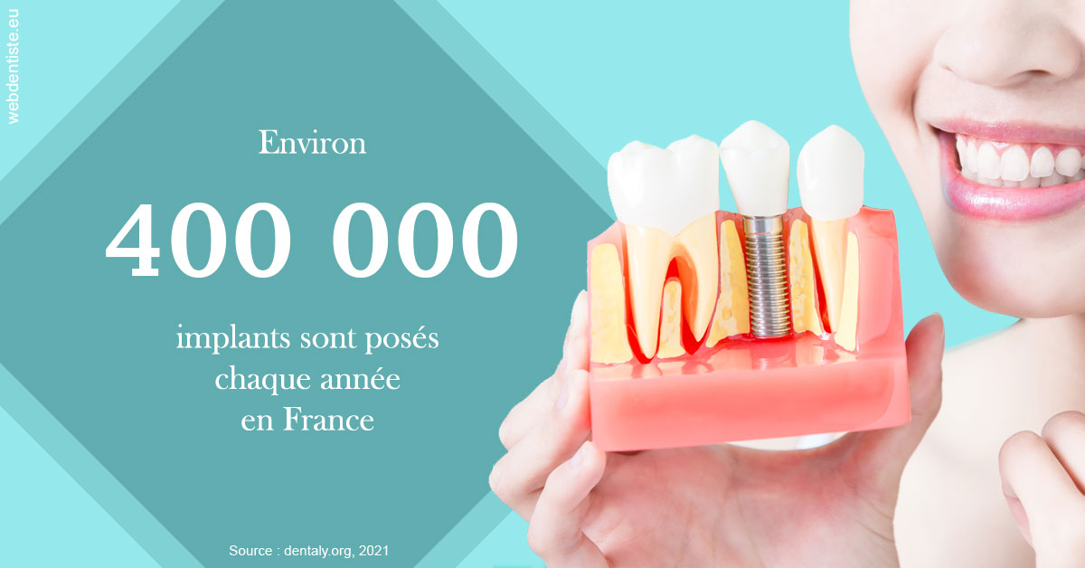 https://www.centredentairetoulon.fr/Pose d'implants en France 2