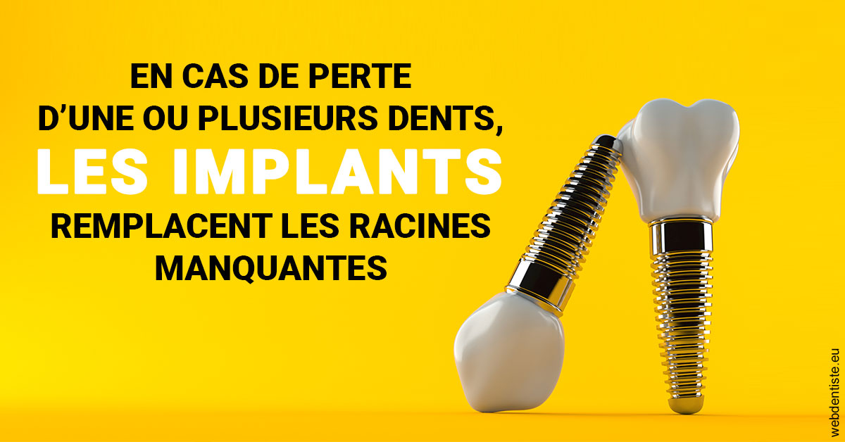 https://www.centredentairetoulon.fr/Les implants 2
